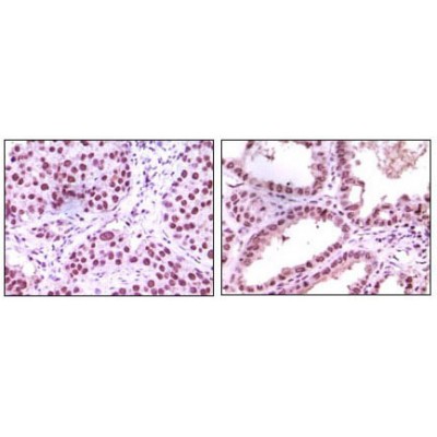 Валидация Affinity BF0551 - 5290