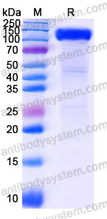 EHH39202, SDS-PAGE