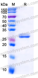 EHJ90502, SDS-PAGE