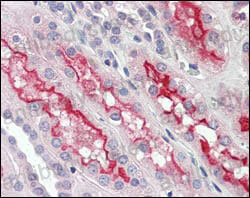 Валидация AntibodySystem RHD18701