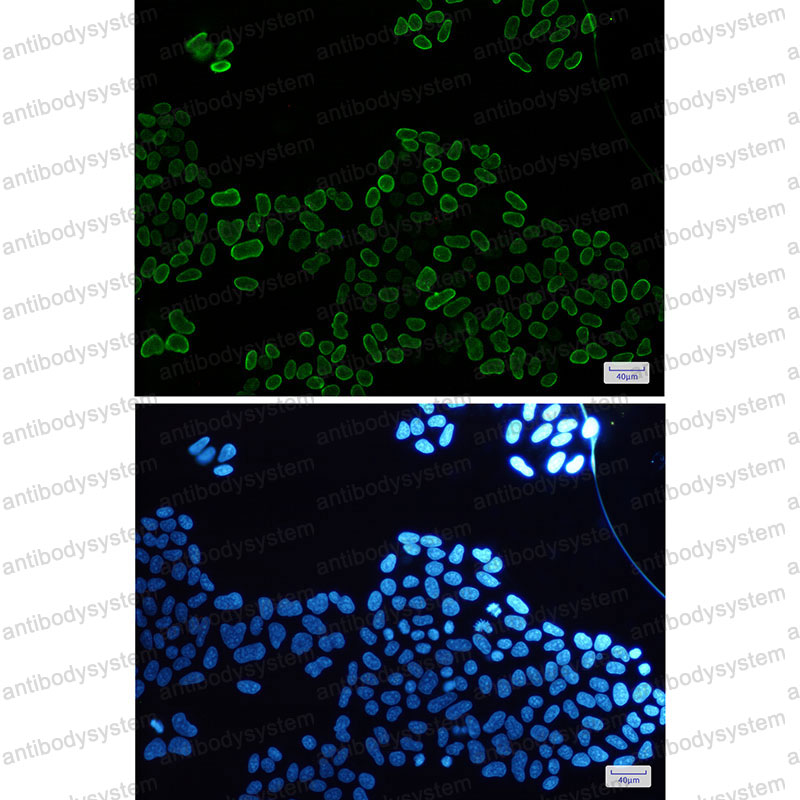 Валидация IF - AntibodySystem RHF85301