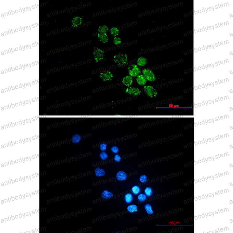 Валидация IF - AntibodySystem RHN86301