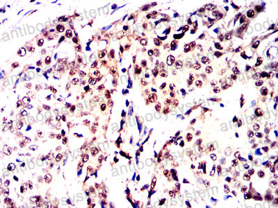 Валидация AntibodySystem RHB26402 (306)