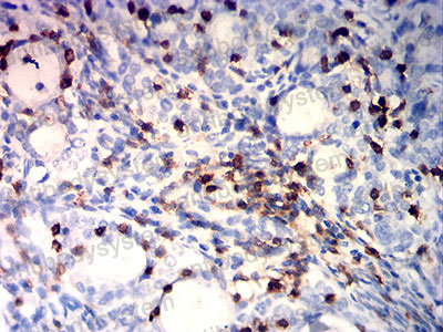 Валидация AntibodySystem RHD69202 (1721)