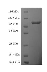 SDS-PAGE