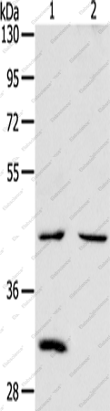 Вестерн-блоттинг, NCEH1, ткань почки и сердца мыши