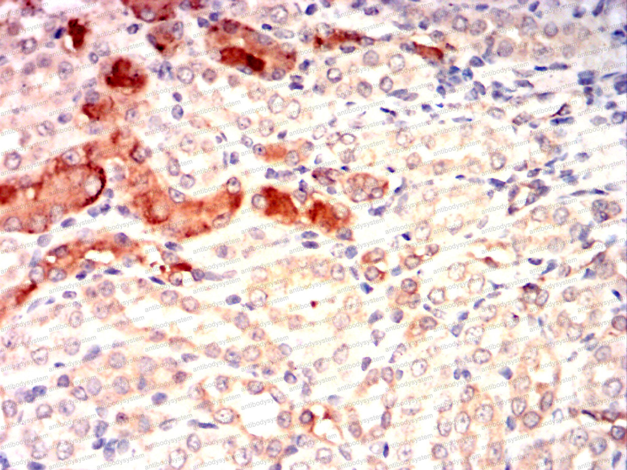 Валидация AntibodySystem RHA16101 (49)