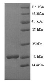 SDS-PAGE