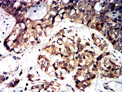 Валидация AntibodySystem RHN14704