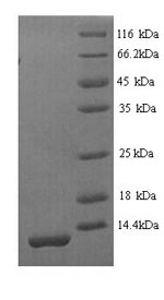 SDS-PAGE