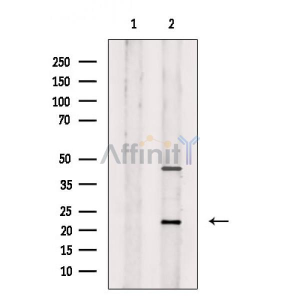 Валидация Affinity AF9222 - 5062