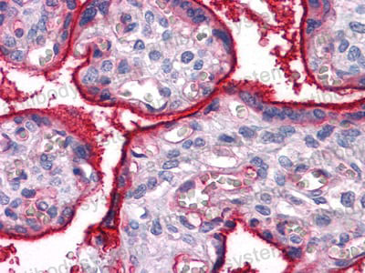 Валидация AntibodySystem RHC35103