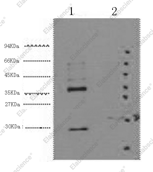 Вестерн-блоттинг, CA9, клетки HeLa и 293T