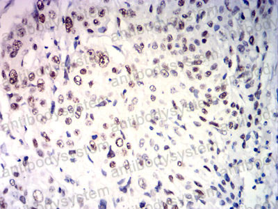 Валидация AntibodySystem RHJ35605 (3388)