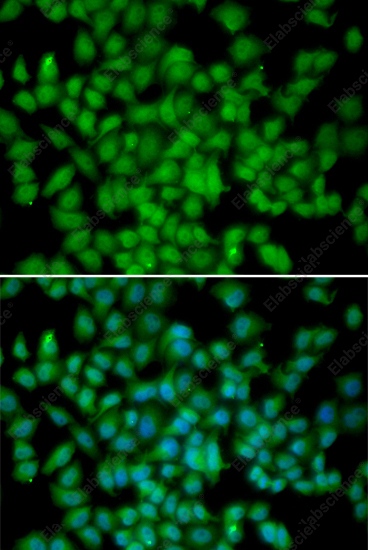 Иммунофлуоресценция, CDKN2C, клетки HeLa