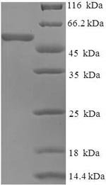 SDS-PAGE