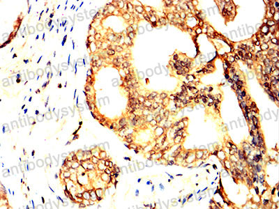 Валидация AntibodySystem RHN87402