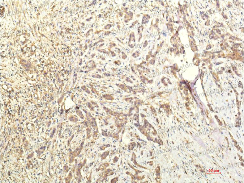 Валидация AntibodySystem RHE34309