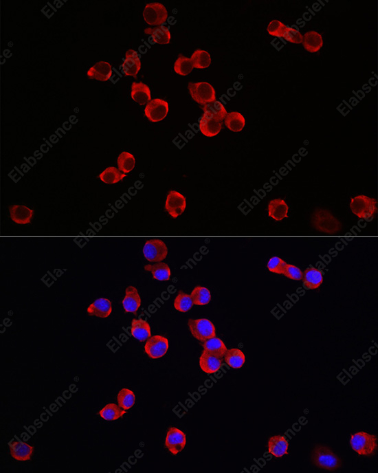 Иммунофлуоресценция, TrkB, клетки Neuro-2a