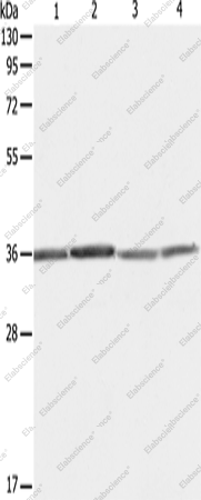 Вестерн-блоттинг, RPLP0, клетки HeLa, 293T, A431 и Jurkat