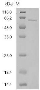 SDS-PAGE
