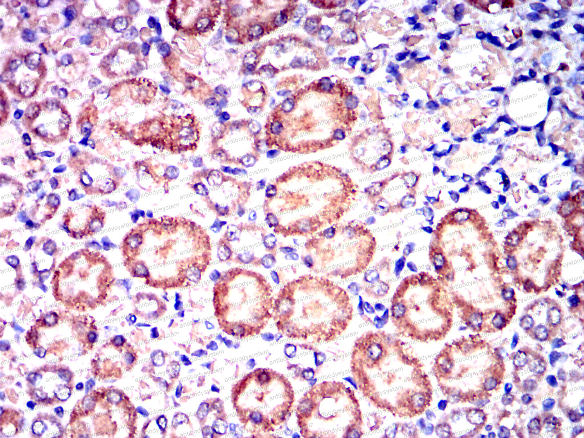 Валидация AntibodySystem RHC15806 (683)