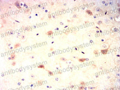 Валидация AntibodySystem RHB26402 (308)