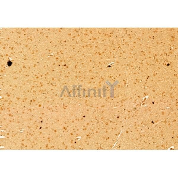 Валидация Affinity AF6362 - 3656