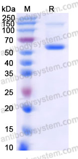 AWD30401, SDS-PAGE