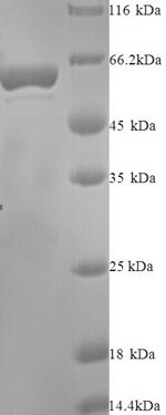 SDS-PAGE