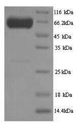 SDS-PAGE