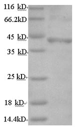 SDS-PAGE