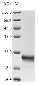 SDS-PAGE