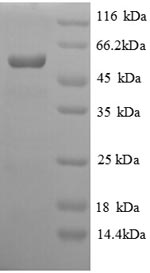 SDS-PAGE