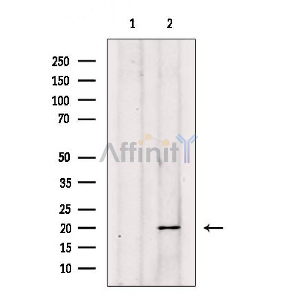 Валидация Affinity DF8238 - 20071
