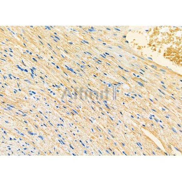 Валидация Affinity DF12499 - 7078