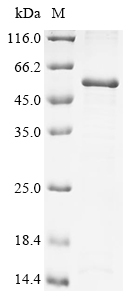 SDS-PAGE