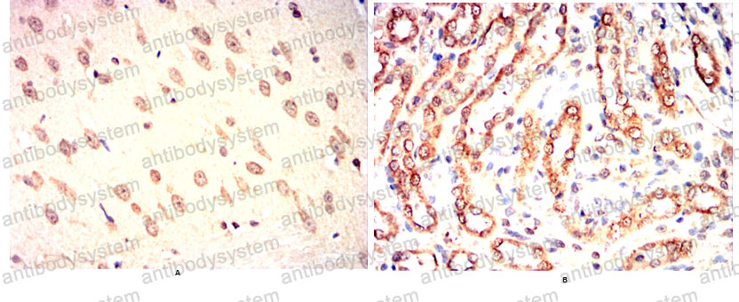Валидация AntibodySystem RHD75202 (1804)