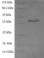 SDS-PAGE