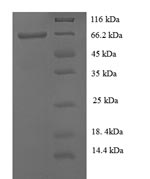 SDS-PAGE