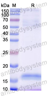 Валидация SDS-PAGE - AntibodySystem RHC27701