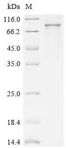 SDS-PAGE