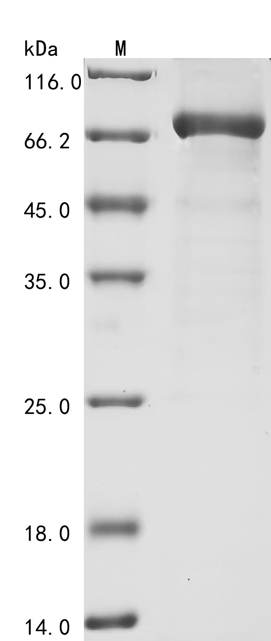 SDS-PAGE