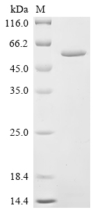 SDS-PAGE
