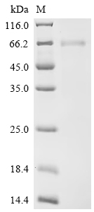 SDS-PAGE