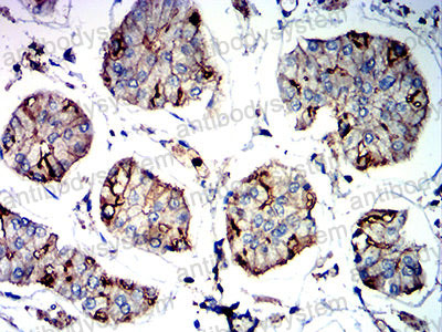 Валидация AntibodySystem RHJ81202