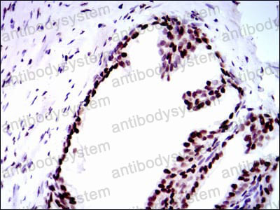 Валидация AntibodySystem RHD74702