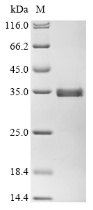 SDS-PAGE