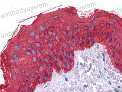 Валидация AntibodySystem RHC99503