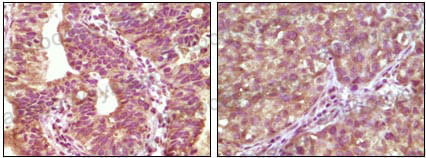 Валидация AntibodySystem RHD08205 (1318)